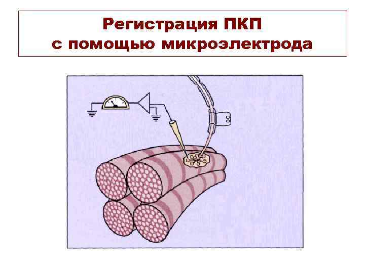 Регистрация ПКП с помощью микроэлектрода 