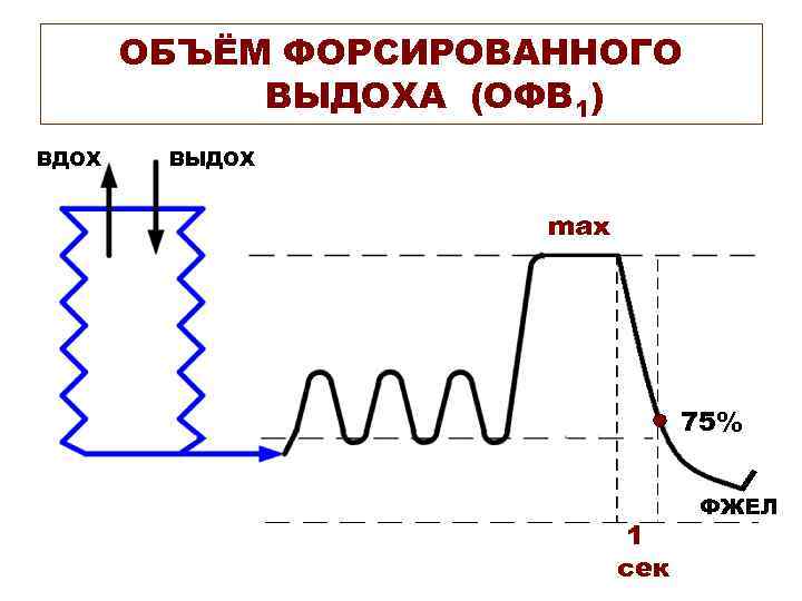 ОБЪЁМ ФОРСИРОВАННОГО ВЫДОХА (ОФВ 1) ВДОХ ВЫДОХ max 75% 1 сек ФЖЕЛ 