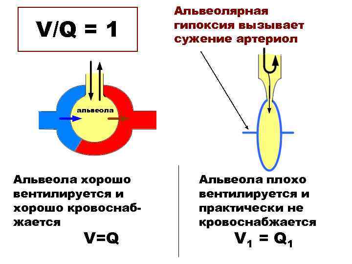 V/Q = 1 Альвеолярная гипоксия вызывает сужение артериол альвеола Альвеола хорошо вентилируется и хорошо