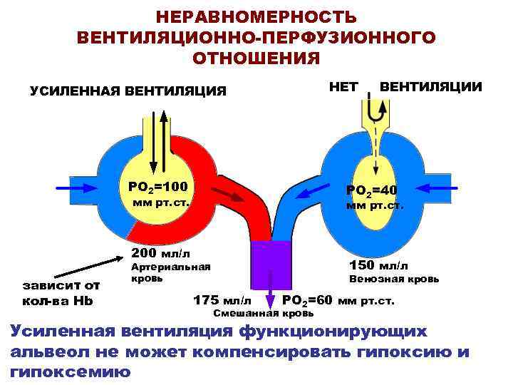 НЕРАВНОМЕРНОСТЬ ВЕНТИЛЯЦИОННО-ПЕРФУЗИОННОГО ОТНОШЕНИЯ НЕТ УСИЛЕННАЯ ВЕНТИЛЯЦИЯ РО 2=100 РО 2=40 мм рт. ст. 200