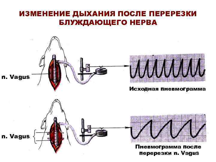 ИЗМЕНЕНИЕ ДЫХАНИЯ ПОСЛЕ ПЕРЕРЕЗКИ БЛУЖДАЮЩЕГО НЕРВА n. Vagus Исходная пневмограмма n. Vagus Пневмограмма после