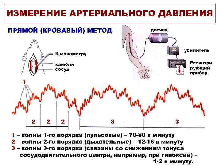 ИЗМЕРЕНИЕ АРТЕРИАЛЬНОГО ДАВЛЕНИЯ ПРЯМОЙ (КРОВАВЫЙ) МЕТОД датчик усилитель К манометру Регистрирующий прибор канюля сосуд