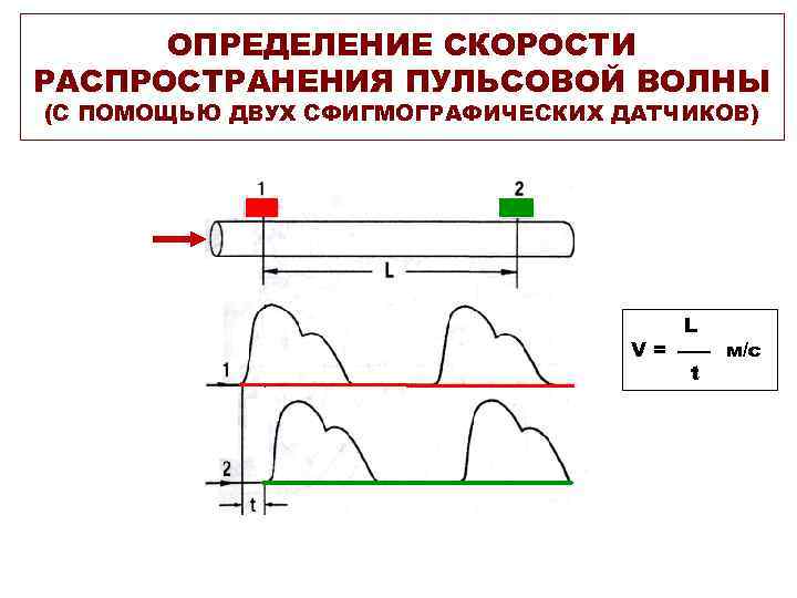 ОПРЕДЕЛЕНИЕ СКОРОСТИ РАСПРОСТРАНЕНИЯ ПУЛЬСОВОЙ ВОЛНЫ (С ПОМОЩЬЮ ДВУХ СФИГМОГРАФИЧЕСКИХ ДАТЧИКОВ) V= L t м/с