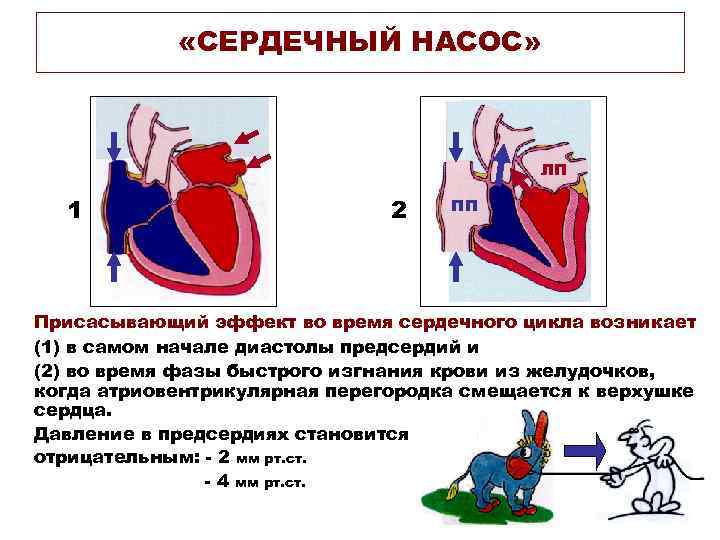  «СЕРДЕЧНЫЙ НАСОС» ЛП 1 2 ПП Присасывающий эффект во время сердечного цикла возникает