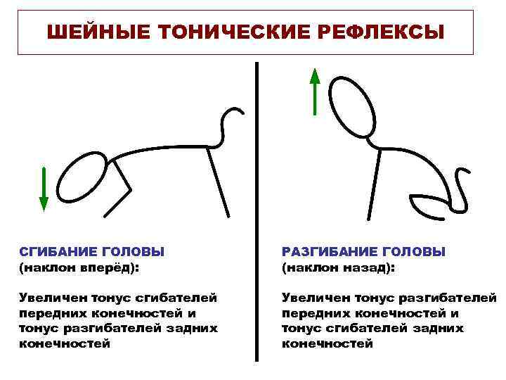 ШЕЙНЫЕ ТОНИЧЕСКИЕ РЕФЛЕКСЫ СГИБАНИЕ ГОЛОВЫ (наклон вперёд): РАЗГИБАНИЕ ГОЛОВЫ (наклон назад): Увеличен тонус сгибателей