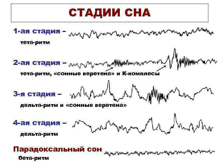 Схема стадий сна по данным ээг