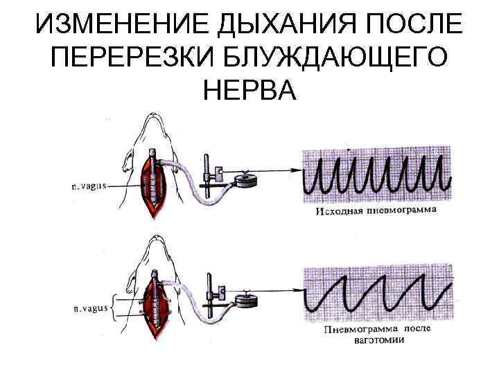 ИЗМЕНЕНИЕ ДЫХАНИЯ ПОСЛЕ ПЕРЕРЕЗКИ БЛУЖДАЮЩЕГО НЕРВА 