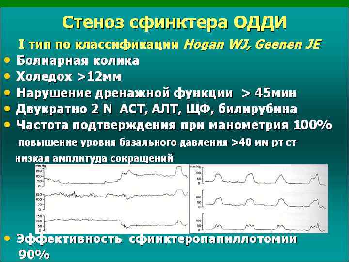 Где находится сфинктер одди у человека фото