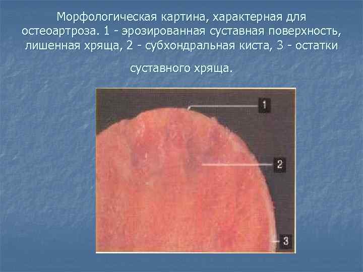 Морфологическая картина что это такое в медицине