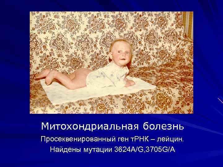 Митохондриальная болезнь Просеквенированный ген т. РНК – лейцин. Найдены мутации 3624 A/G, 3705 G/A