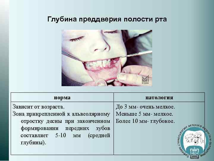 Глубина преддверия полости рта норма патология Зависит от возраста. До 3 мм- очень мелкое.