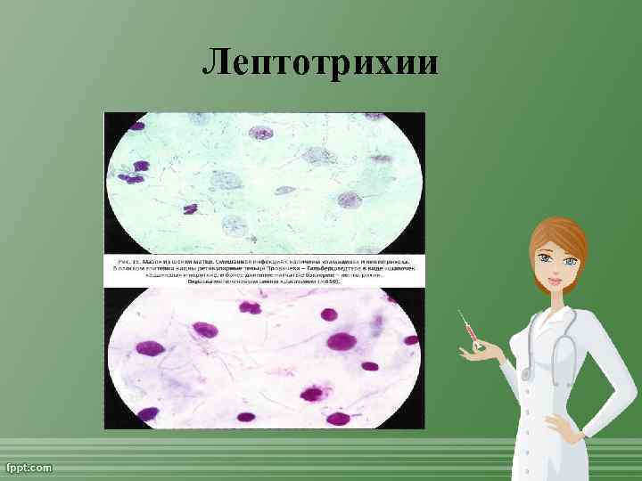 Лептотрихии 