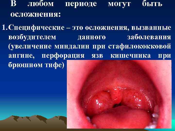 В любом периоде осложнения: могут быть 1. Специфические – это осложнения, вызванные возбудителем данного