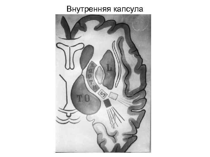 Внутренняя капсула 