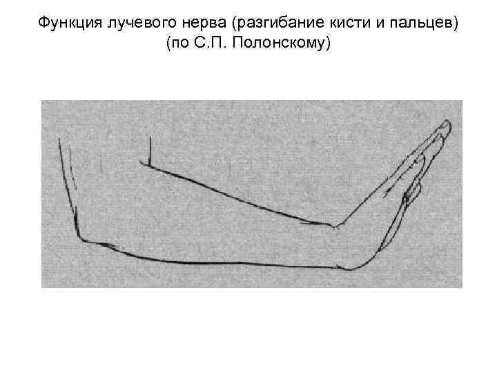 Функция лучевого нерва (разгибание кисти и пальцев) (по С. П. Полонскому) 
