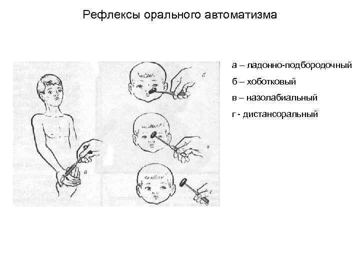 Рефлексы орального автоматизма