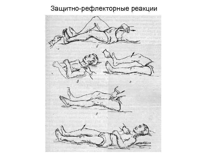 Защитно рефлекторные реакции 
