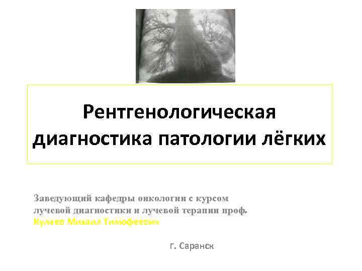 Рентгенологическая диагностика патологии лёгких Заведующий кафедры онкологии с курсом лучевой диагностики и лучевой терапии