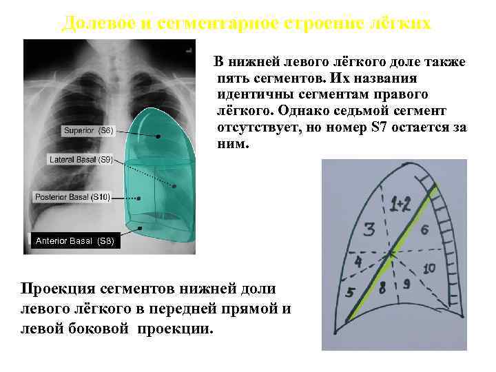 Правое легкое состоит из. Сегменты левого легкого. Сегмент s7 правого легкого. Нижняя доля левого легкого. Нижняя доля правого легкого.