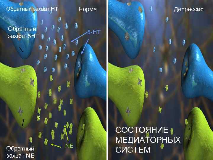 Обратный захват HT Норма Обратный захват 5 HT Обратный захват NE Депрессия 5 -HT