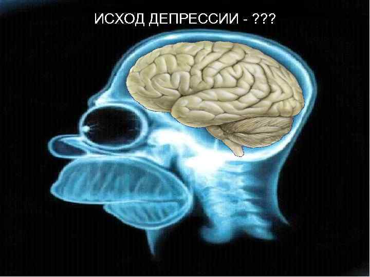ИСХОД ДЕПРЕССИИ - ? ? ? 