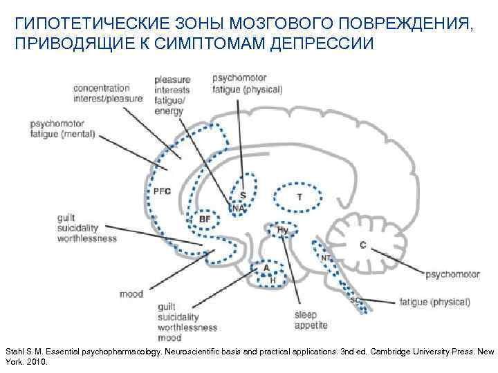 ГИПОТЕТИЧЕСКИЕ ЗОНЫ МОЗГОВОГО ПОВРЕЖДЕНИЯ, ПРИВОДЯЩИЕ К СИМПТОМАМ ДЕПРЕССИИ Stahl S. M. Essential psychopharmacology. Neuroscientific