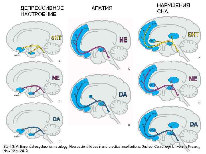 ДЕПРЕССИВНОЕ НАСТРОЕНИЕ АПАТИЯ НАРУШЕНИЯ СНА Stahl S. M. Essential psychopharmacology. Neuroscientific basis and practical
