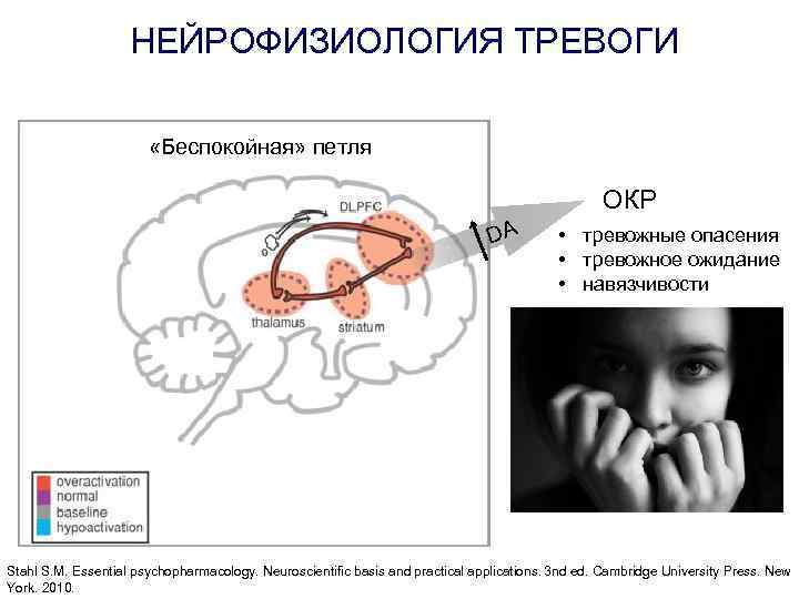 НЕЙРОФИЗИОЛОГИЯ ТРЕВОГИ «Беспокойная» петля ОКР DA • тревожные опасения • тревожное ожидание • навязчивости