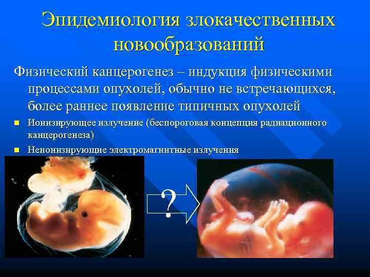 Эпидемиология злокачественных новообразований Физический канцерогенез – индукция физическими процессами опухолей, обычно не встречающихся, более