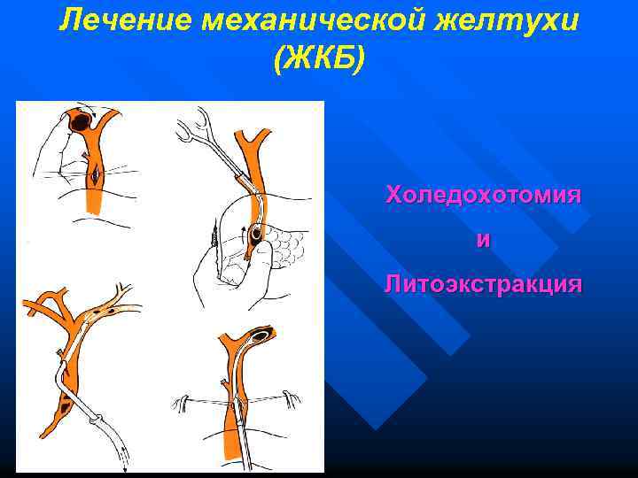 Механическая желтуха карта вызова