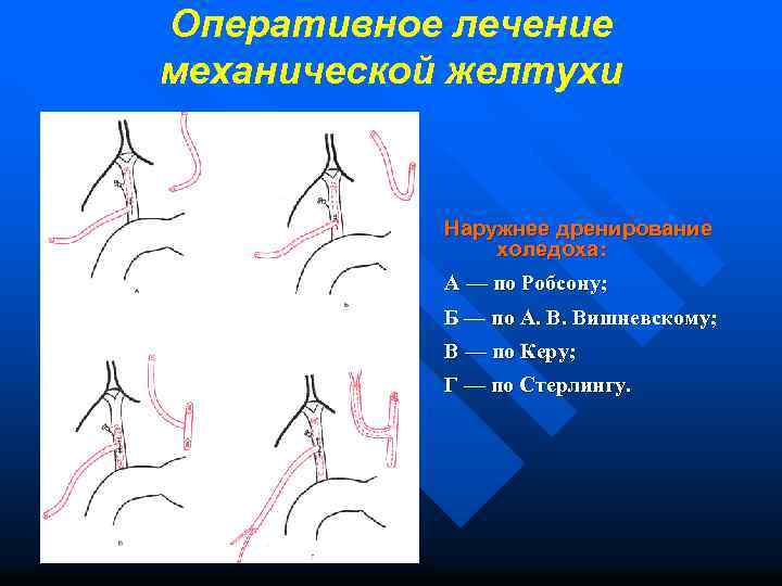 Механическая желтуха карта вызова