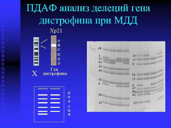 ПДАФ анализ делеций гена дистрофина при МДД Хр21 -А -B -C -D -E -F