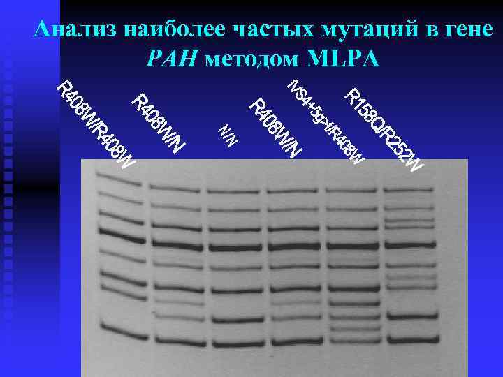 Анализ наиболее частых мутаций в гене PAH методом MLPA 