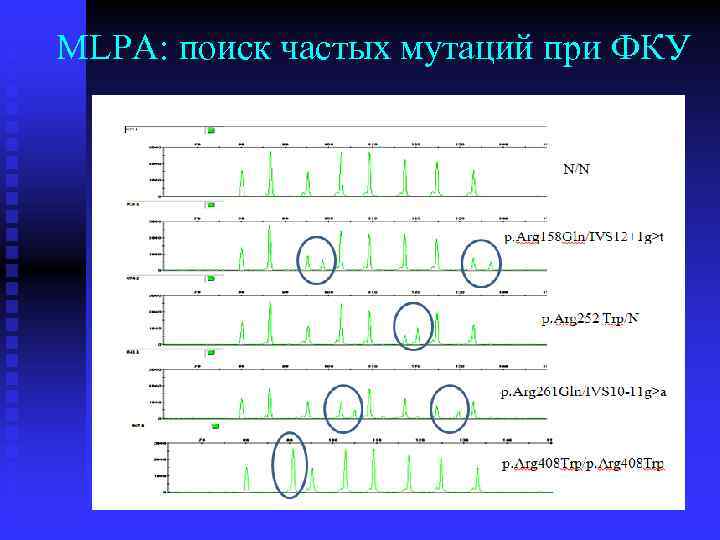 MLPA: поиск частых мутаций при ФКУ 