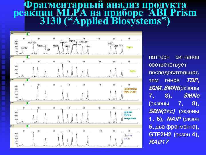 Фрагментарный анализ продукта реакции MLPA на приборе ABI Prism 3130 (“Applied Biosystems”) паттерн сигналов