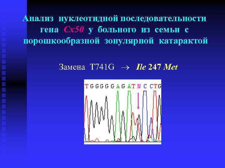 Анализ нуклеотидной последовательности гена Cx 50 у больного из семьи с порошкообразной зонулярной катарактой