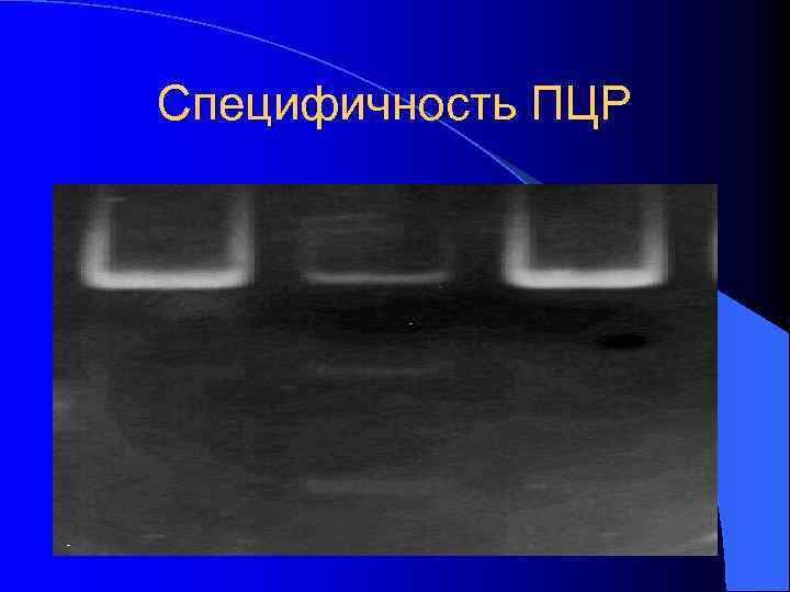 Специфичность ПЦР 