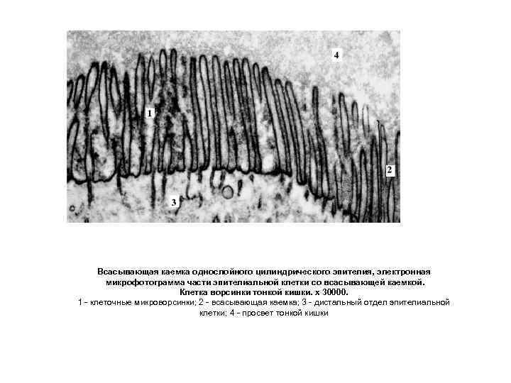 Всасывающая каемка однослойного цилиндрического эпителия, электронная микрофотограмма части эпителиальной клетки со всасывающей каемкой. Клетка