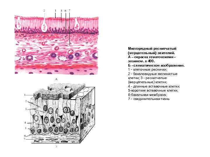Многорядный реснитчатый (мерцательный) эпителий. А – окраска гематоксилин эозином. х 400. Б - схематическое