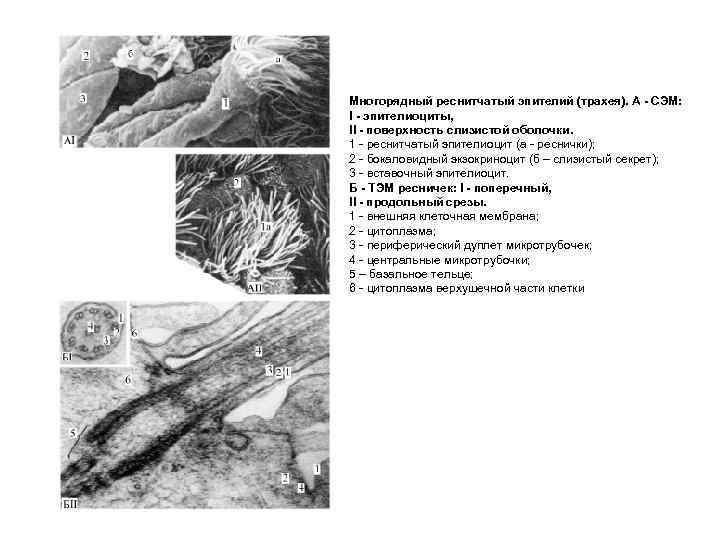 Многорядный реснитчатый эпителий (трахея). А - СЭМ: І - эпителиоциты, II - поверхность слизистой