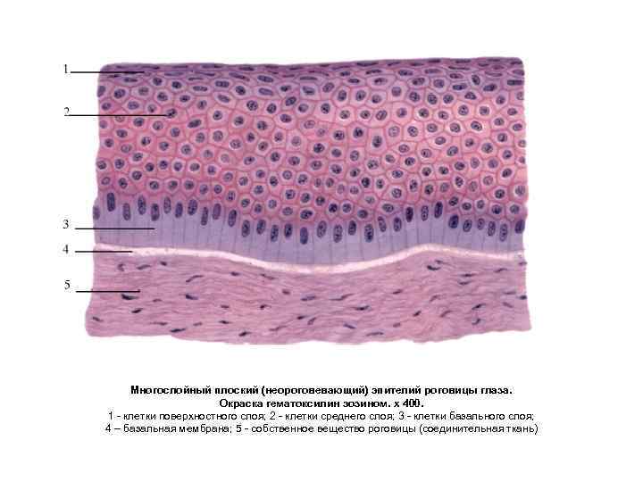 Многослойный плоский (неороговевающий) эпителий роговицы глаза. Окраска гематоксилин эозином. х 400. 1 клетки поверхностного