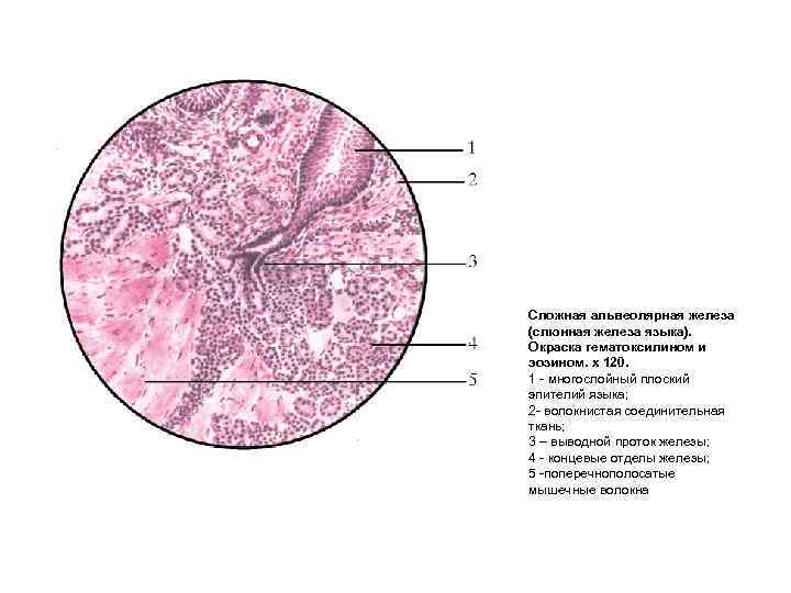 Сложная альвеолярная железа (слюнная железа языка). Окраска гематоксилином и эозином. х 120. 1 многослойный