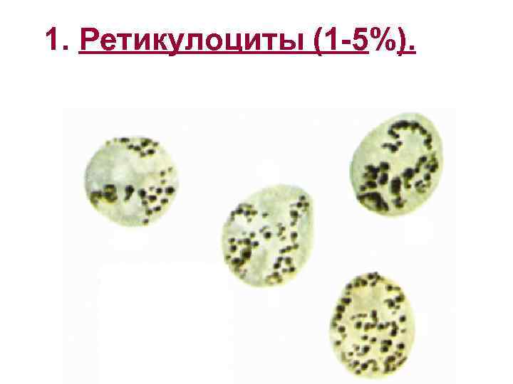 1. Ретикулоциты (1 -5%). 1 1 