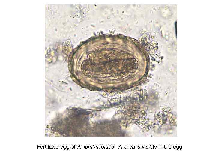 Fertilized egg of A. lumbricoides. A larva is visible in the egg 