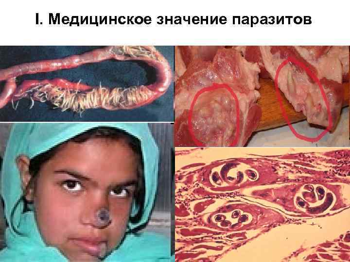I. Медицинское значение паразитов 