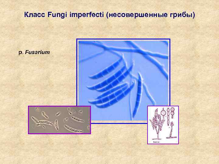 Класс Fungi imperfecti (несовершенные грибы) p. Fusarium 