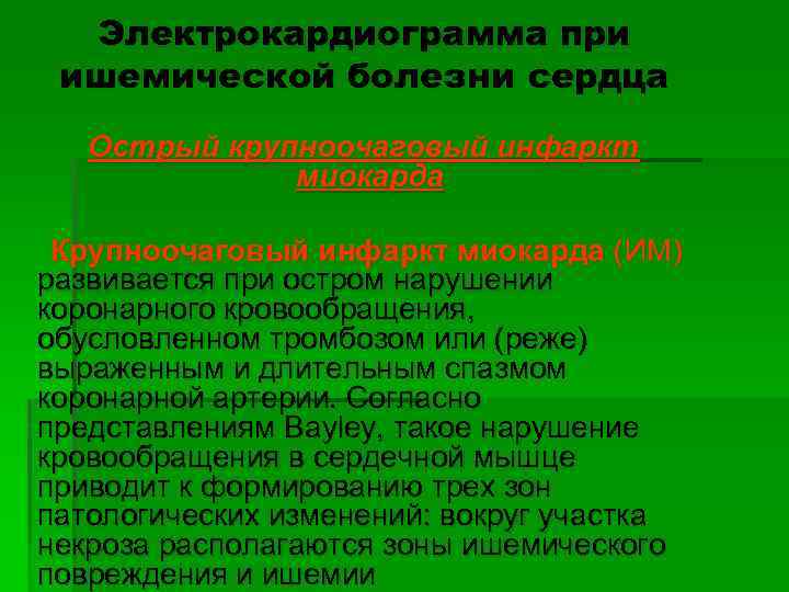 Электрокардиограмма при ишемической болезни сердца Острый крупноочаговый инфаркт миокарда Крупноочаговый инфаркт миокарда (ИМ) развивается