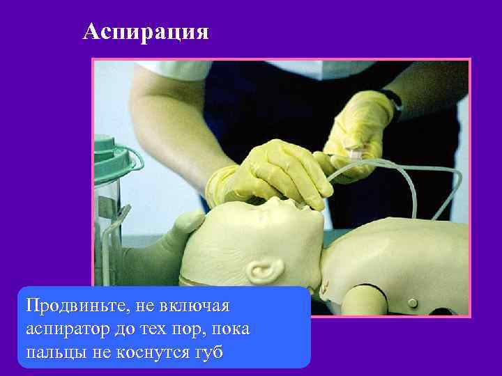 Аспирация Продвиньте, не включая аспиратор до тех пор, пока пальцы не коснутся губ 