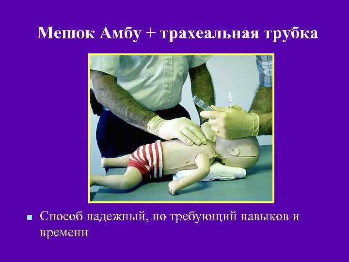 Мешок Амбу + трахеальная трубка n Способ надежный, но требующий навыков и времени 
