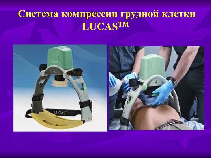 Система компрессии грудной клетки LUCASTM 